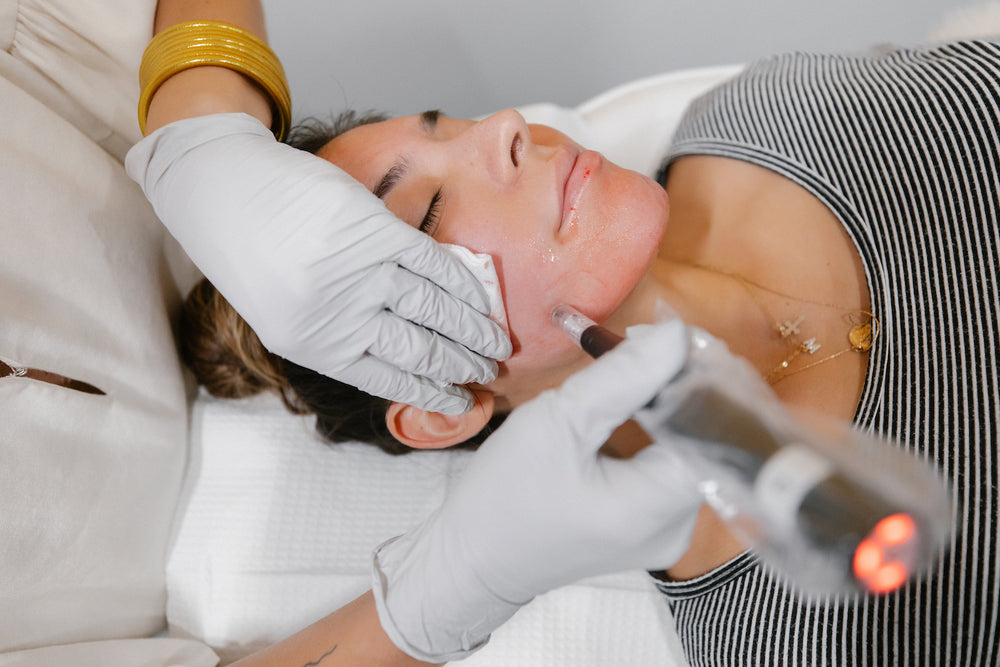 Microneedling Featured Image